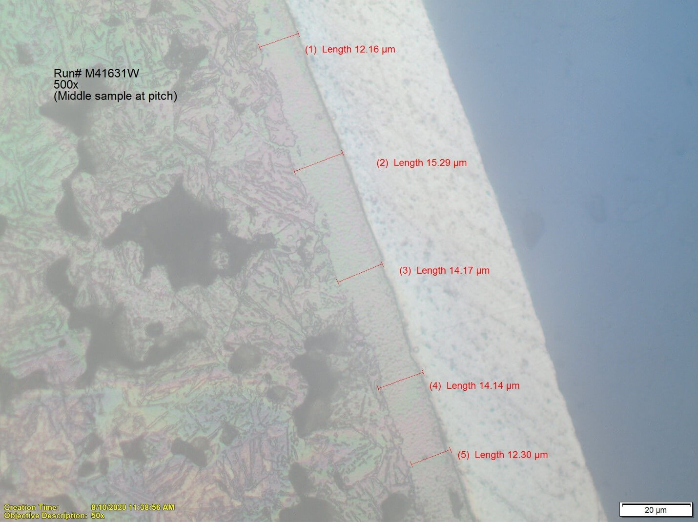 Photomicrograph of PM