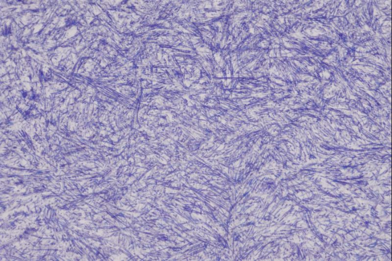Microstructure of Cryogenic 9310 at 1000X